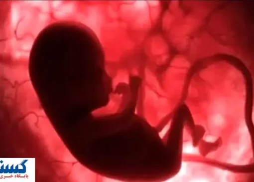 دولت شرایط سقط جنین قانونی را اعلام کرد | کدام روش بهتر است د؟